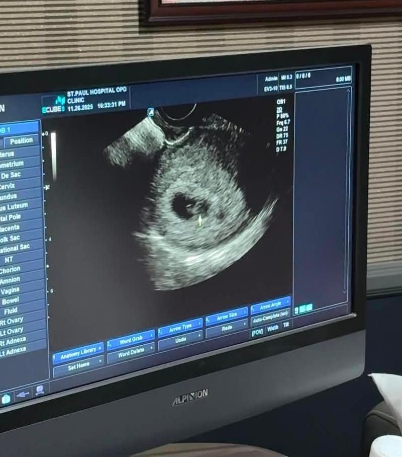 The first little heartbeat